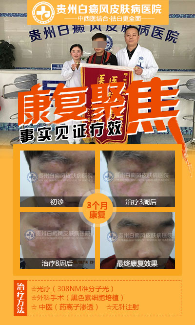 朝阳医院皮肤科大夫介绍_朝阳医院的皮肤科_朝阳医院皮肤科大夫