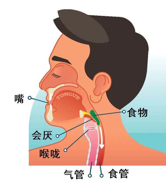 运动型哮喘_运动性哮喘怎么运动_运动性哮喘的症状