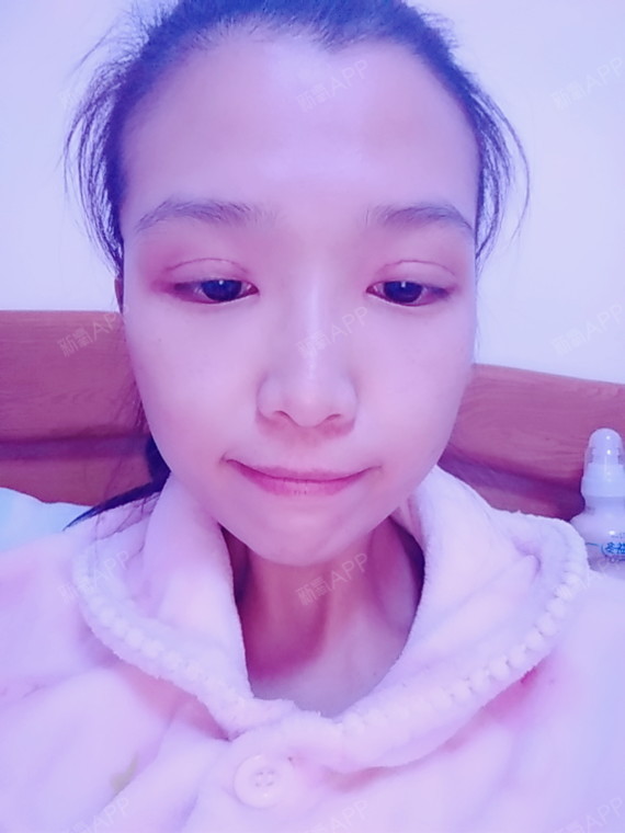 多长手术恢复肛瘘时间后会复发_肛瘘手术后多久能长平_肛瘘手术后多长时间恢复