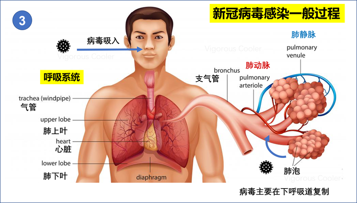 呼吸道合胞体病毒感染_呼吸道合胞病毒感染_呼吸道合胞病毒病毒