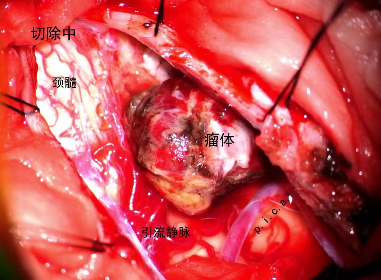 上海哪家医院看胃病好_上海胃病医院好看的有哪些_上海胃病医院好看吗