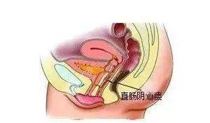 多长手术好肛瘘时间长一点_多长手术好肛瘘时间久_肛瘘手术多长时间好